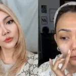 Rina Nose Ungkap Post-Op Blues dan Keputusan Childfree: Kisah Emosional di Balik Operasi Hidung